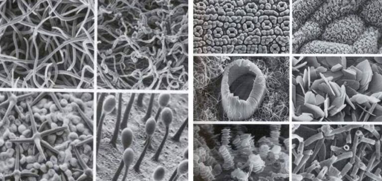 Figure 2 electron micrographs - high definition macro photos - of different deposits on leaves