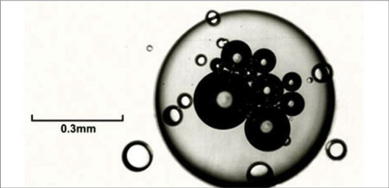 Figure 11 Air inclusions shown within a very coarse to extra coarse droplet