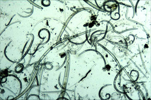 Free living nematode community extracted from soil viewed with light microscopy