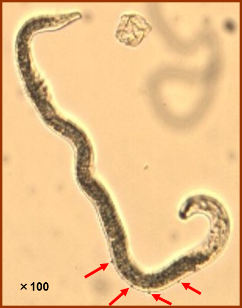 Figure 2. Root-lesion nematode (Pratylenchus thornei) infested with parasitic bacteria (Pasteuria sp.) as indicated by the red arrows.