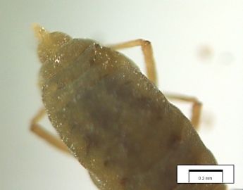 Image showing rear end of Russian Wheat Aphid with indistinct short siphuncles